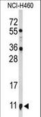 S100 Calcium Binding Protein A10 antibody, LS-C162827, Lifespan Biosciences, Western Blot image 