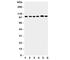 ADAM Metallopeptidase With Thrombospondin Type 1 Motif 5 antibody, R31183, NSJ Bioreagents, Western Blot image 