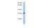 Serine And Arginine Rich Splicing Factor 10 antibody, GTX47231, GeneTex, Western Blot image 