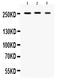 Sodium Voltage-Gated Channel Alpha Subunit 1 antibody, PB9887, Boster Biological Technology, Western Blot image 