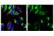 SEC61 Translocon Beta Subunit antibody, 14648S, Cell Signaling Technology, Immunofluorescence image 