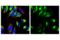 Protein transport protein Sec61 subunit beta antibody, 14648S, Cell Signaling Technology, Immunofluorescence image 