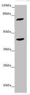 Long-chain-fatty-acid--CoA ligase 6 antibody, LS-C675354, Lifespan Biosciences, Western Blot image 