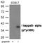 NFKB Inhibitor Alpha antibody, GTX55428, GeneTex, Western Blot image 