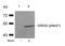 Glycogen Synthase Kinase 3 Alpha antibody, P03152, Boster Biological Technology, Western Blot image 