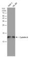 Cystatin A antibody, PA5-77929, Invitrogen Antibodies, Western Blot image 