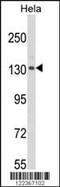 CAP-Gly Domain Containing Linker Protein 1 antibody, MBS9205387, MyBioSource, Western Blot image 