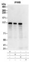 Tripartite Motif Containing 28 antibody, NB500-159, Novus Biologicals, Immunoprecipitation image 