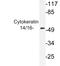 Keratin 14 antibody, LS-C176091, Lifespan Biosciences, Western Blot image 