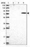 Zinc finger protein KOX4 antibody, NBP1-83264, Novus Biologicals, Western Blot image 