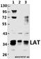Linker For Activation Of T Cells antibody, A01654, Boster Biological Technology, Western Blot image 