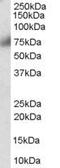 Fibroblast Growth Factor Receptor 1 antibody, PA5-18344, Invitrogen Antibodies, Western Blot image 