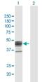 SIAT4 antibody, H00006482-B01P, Novus Biologicals, Western Blot image 