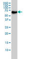 CDKN2A Interacting Protein antibody, LS-C133775, Lifespan Biosciences, Western Blot image 