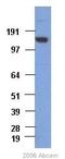 RAD50 Double Strand Break Repair Protein antibody, ab89, Abcam, Western Blot image 