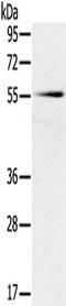 Solute Carrier Family 16 Member 10 antibody, TA351678, Origene, Western Blot image 