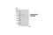 Bruton Tyrosine Kinase antibody, 3537S, Cell Signaling Technology, Western Blot image 