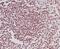 RNA Polymerase II Subunit A antibody, P01029-2, Boster Biological Technology, Immunohistochemistry paraffin image 