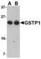 Glutathione S-Transferase Pi 1 antibody, MBS150650, MyBioSource, Western Blot image 