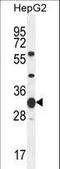 Spermatogenesis- and oogenesis-specific basic helix-loop-helix-containing protein 1 antibody, LS-C161387, Lifespan Biosciences, Western Blot image 