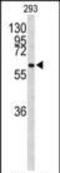 CDC73 antibody, PA5-26189, Invitrogen Antibodies, Western Blot image 