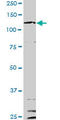 Interleukin 6 Signal Transducer antibody, LS-C197517, Lifespan Biosciences, Western Blot image 