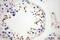 Hemogen antibody, 17616-1-AP, Proteintech Group, Immunohistochemistry frozen image 