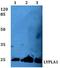 Lysophospholipase 1 antibody, A07249-1, Boster Biological Technology, Western Blot image 