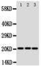 Surfactant Protein C antibody, PA5-79988, Invitrogen Antibodies, Western Blot image 