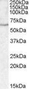 Serpin Family A Member 10 antibody, GTX88707, GeneTex, Western Blot image 