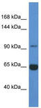 Mannosidase Alpha Class 2A Member 2 antibody, TA339033, Origene, Western Blot image 