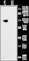 Hyperpolarization Activated Cyclic Nucleotide Gated Potassium Channel 1 antibody, GTX54823, GeneTex, Western Blot image 