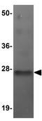 Transmembrane Protein 70 antibody, GTX85199, GeneTex, Western Blot image 