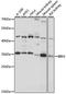 Bridging Integrator 3 antibody, A11817, Boster Biological Technology, Western Blot image 