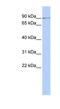 Zinc Finger Protein 433 antibody, NBP1-80165, Novus Biologicals, Western Blot image 