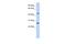 PRAME Family Member 10 antibody, A16709, Boster Biological Technology, Western Blot image 