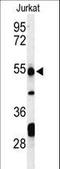 Prune Exopolyphosphatase 1 antibody, LS-B10719, Lifespan Biosciences, Western Blot image 