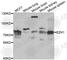 Enhancer Of Zeste 1 Polycomb Repressive Complex 2 Subunit antibody, A5818, ABclonal Technology, Western Blot image 