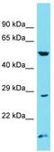 Autophagy Related 101 antibody, TA330711, Origene, Western Blot image 