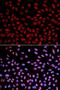 DNA Polymerase Eta antibody, orb48495, Biorbyt, Immunofluorescence image 