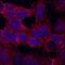 Transmembrane Protein 204 antibody, MA5-24293, Invitrogen Antibodies, Immunocytochemistry image 