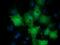 Protein lin-7 homolog B antibody, GTX84216, GeneTex, Immunocytochemistry image 