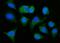 Aldehyde Dehydrogenase 1 Family Member A1 antibody, M01392-2, Boster Biological Technology, Immunofluorescence image 