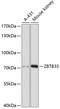 Zinc Finger And BTB Domain Containing 33 antibody, GTX66129, GeneTex, Western Blot image 
