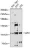 Leucine Rich Repeat Containing G Protein-Coupled Receptor 4 antibody, 14-567, ProSci, Western Blot image 