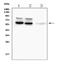 Tyrosine Hydroxylase antibody, MA1100, Boster Biological Technology, Western Blot image 