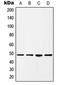 Histone Acetyltransferase 1 antibody, LS-C353069, Lifespan Biosciences, Western Blot image 