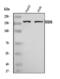 MutS Homolog 6 antibody, A00553-3, Boster Biological Technology, Western Blot image 