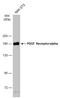 Platelet Derived Growth Factor Receptor Alpha antibody, GTX133588, GeneTex, Western Blot image 