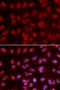 SIN3 Transcription Regulator Family Member A antibody, STJ25530, St John